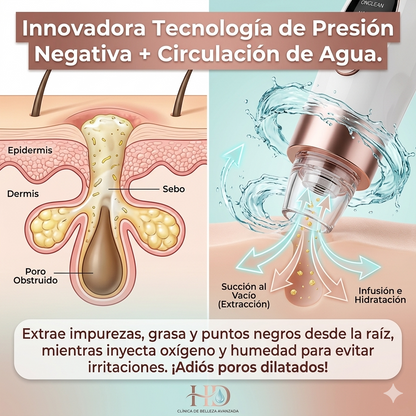 ¡Elimina los Puntos Negros sin Dejar tu Piel Roja! - EXTRACTOR DE ESPINILLAS