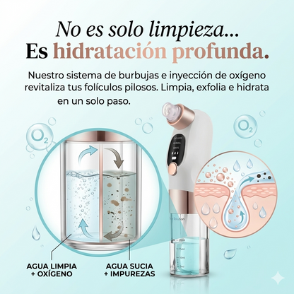 ¡Elimina los Puntos Negros sin Dejar tu Piel Roja! - EXTRACTOR DE ESPINILLAS